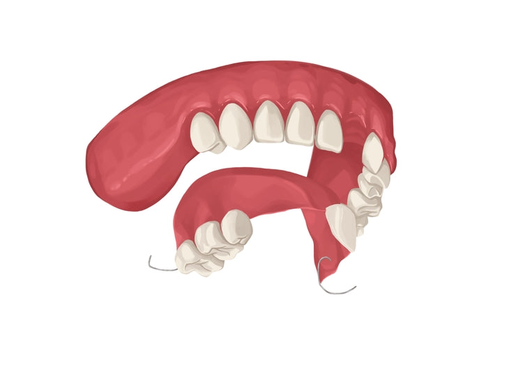 What is a Flipper Tooth?